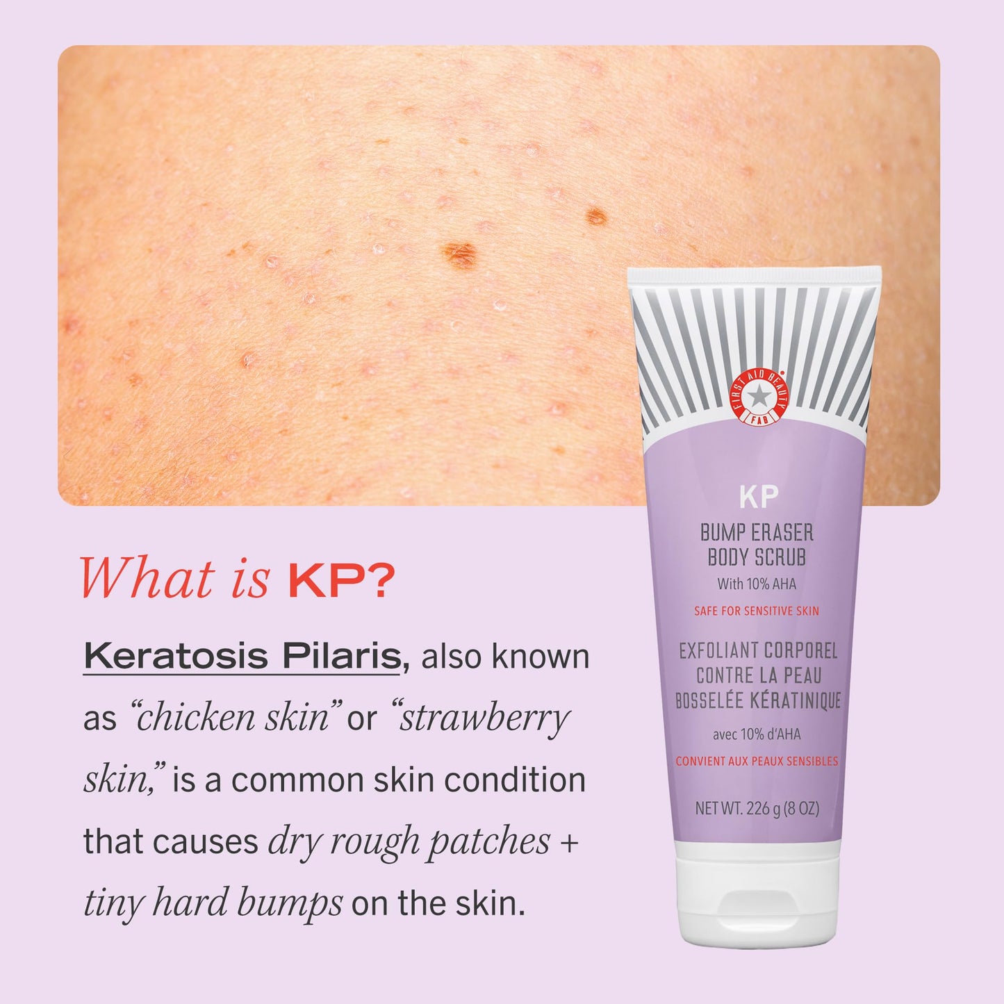 First Aid Beauty KP Bump Eraser Body Scrub Exfoliant for Keratosis Pilaris with 10% AHA 2 oz.